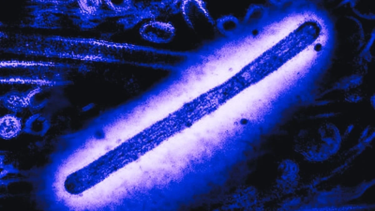 Particella virale dell'influenza aviaria H5N1 al microscopio elettronico